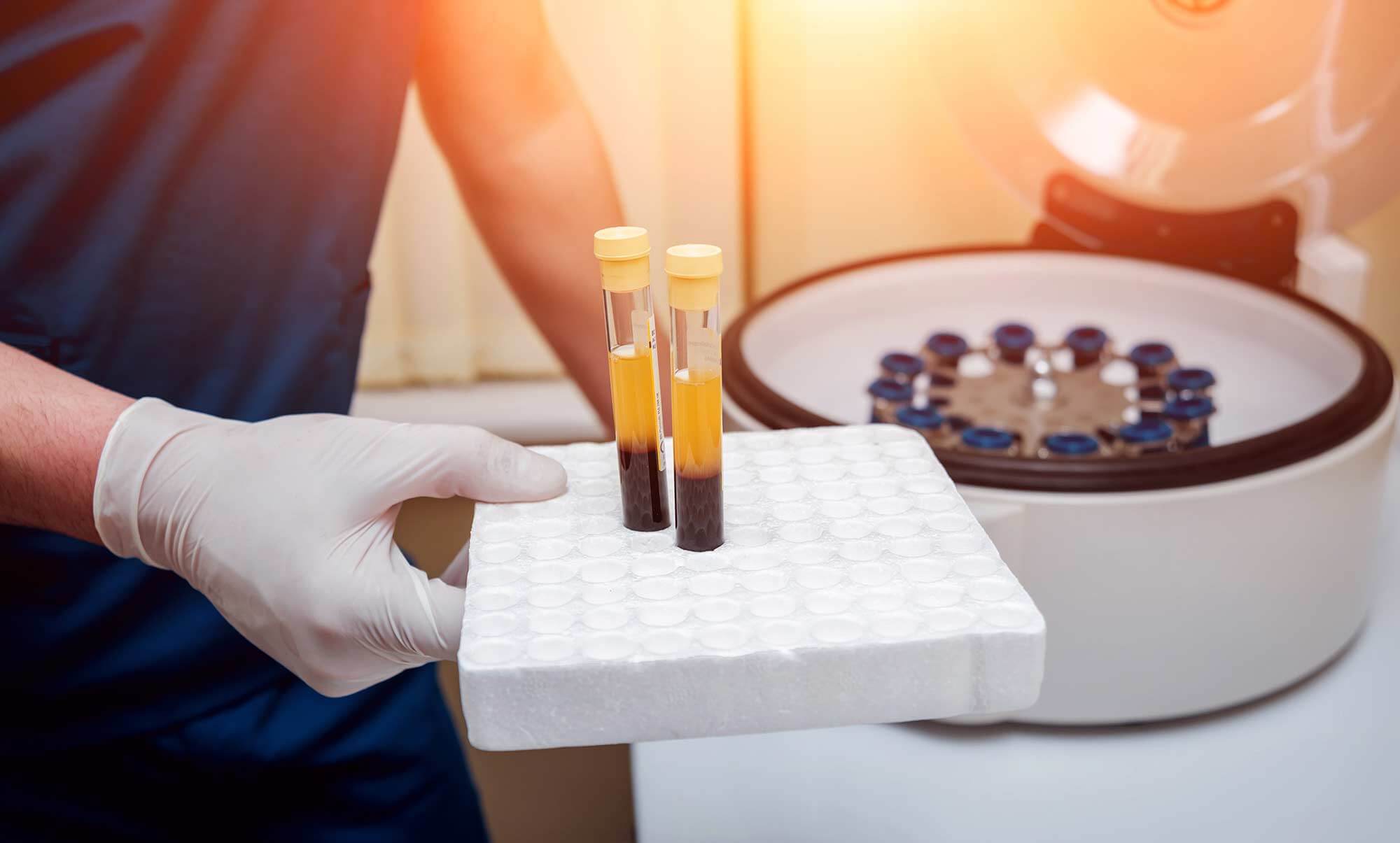 Concentrated cells separated in a centrifuge