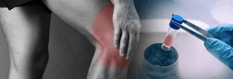 Is Regenerative Medicine a Great Treatment for Pain