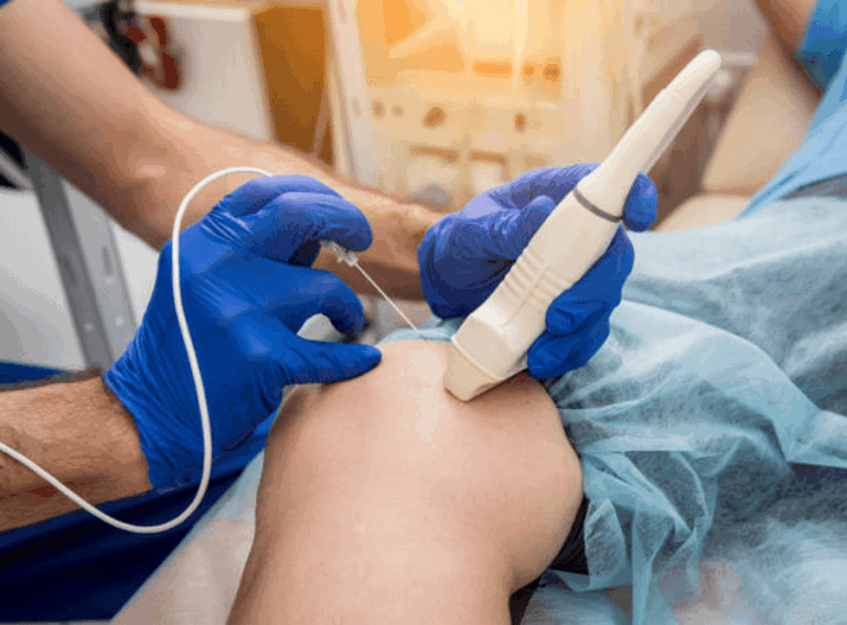 Top Benefits of Managing Pain with Radiofrequency Ablation.