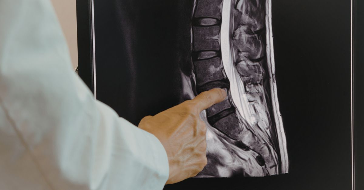 Physiatrist reviewing a lumbar spine MRI with a patient at Advanced Sports & Spine in Huntersville, NC
